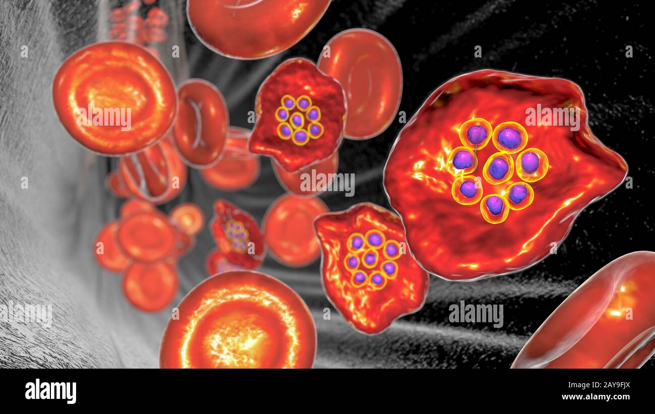 Plasmodium ovale à l'intérieur de la cellule de sang rouge, illustration Banque D'Images