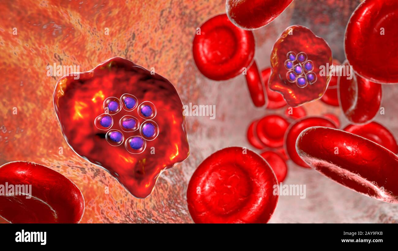 Plasmodium ovale à l'intérieur de la cellule de sang rouge, illustration Banque D'Images