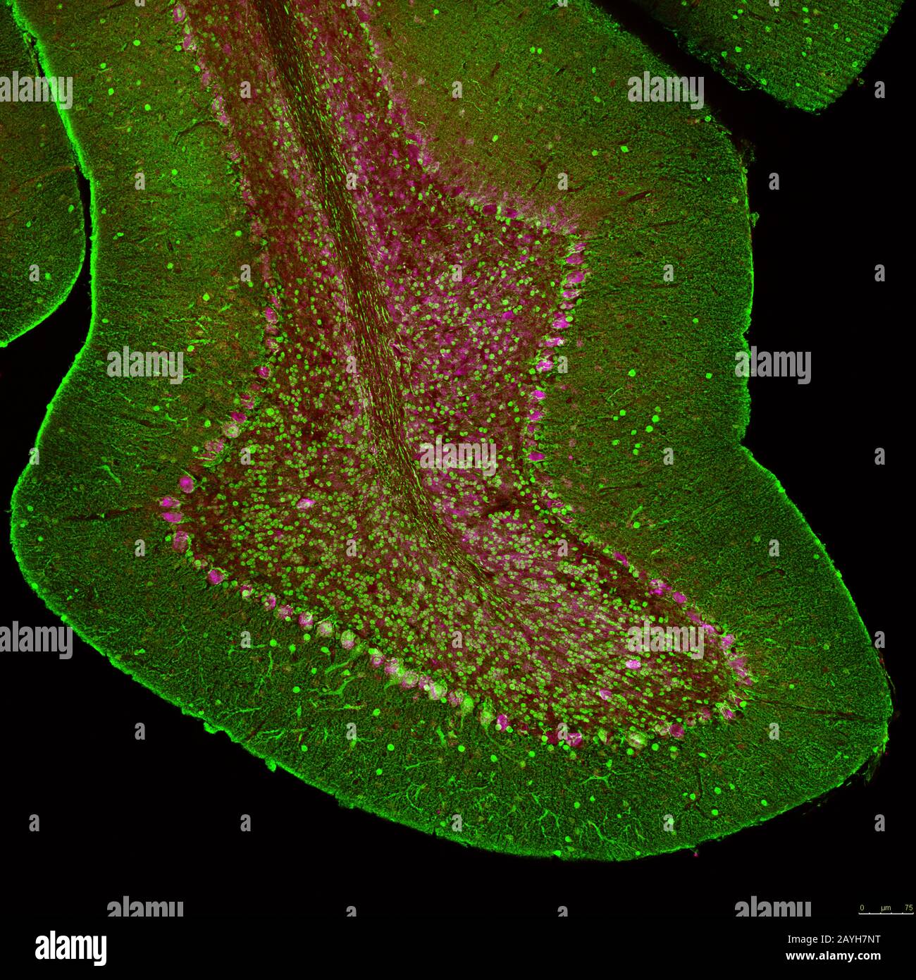 Folium cérébelleux provenant d'une section du cerveau de souris, marqué par  immunofluorescence et enregistré par microscopie confocale à balayage laser.  Grand Purkinje Photo Stock - Alamy