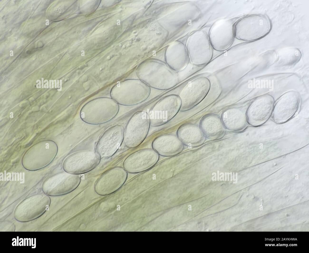 Plusieurs asci (cellules portantes de spores de champignons ascomycètes) provenant d'eau sale, photographiés à l'aide d'un objectif de microscope à huile 100× Banque D'Images