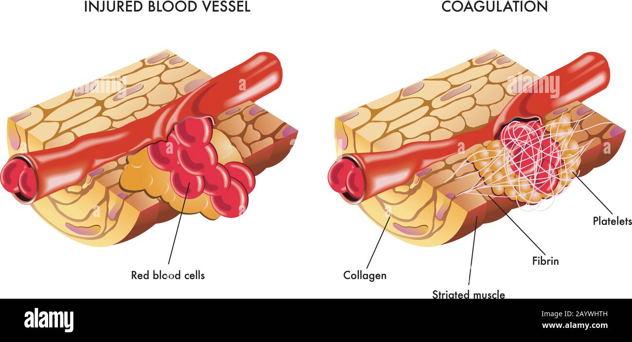 Illustration médicale du processus de coagulation du sang. Illustration de Vecteur