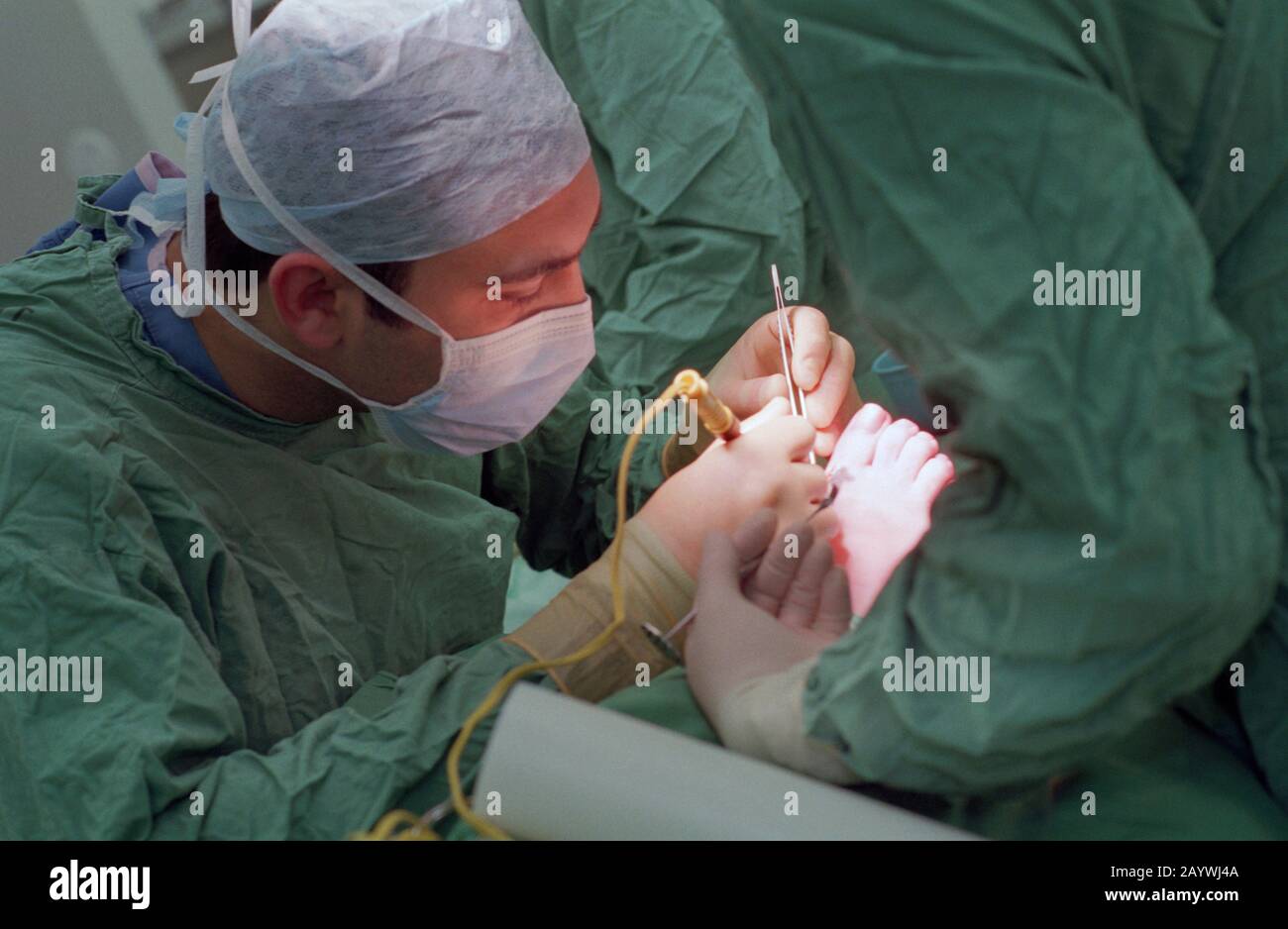 Chirurgie du Pied Banque D'Images