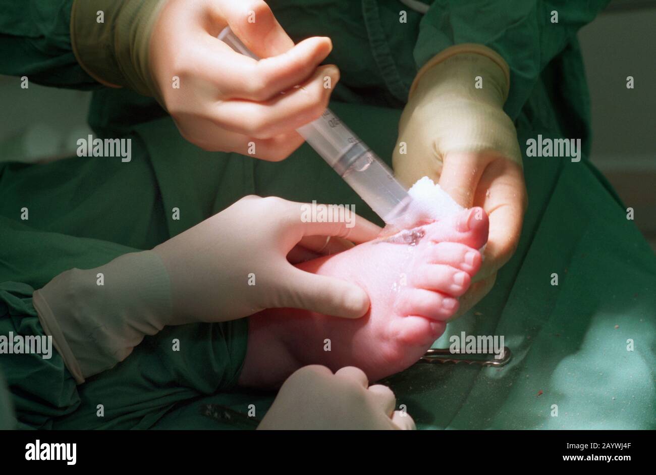 Chirurgie du Pied Banque D'Images
