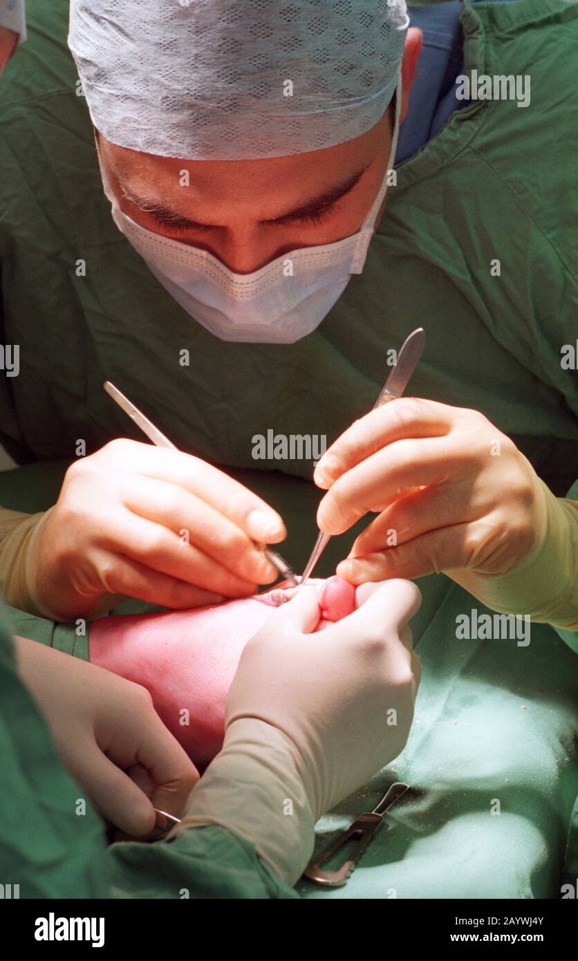 Chirurgie du Pied Banque D'Images