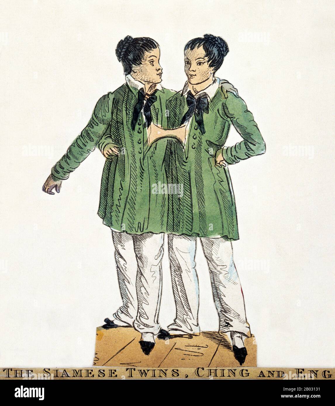 Chang et Eng Bunker (11 mai 1811 – 17 janvier 1874) étaient des frères jumeaux thaïlandais-américains dont la condition et le lieu de naissance sont devenus la base du terme 'jumeaux siamois'. Les frères Bunker sont nés le 11 mai 1811 dans la province de Samut Songkram, près de Bangkok, dans le Royaume de Siam (Thaïlande d'aujourd'hui). Leur père pêcheur était un Chinois thaïlandais, alors que leur mère était un Chinois malaisien. En raison de leur héritage chinois, ils étaient connus localement sous le nom de "Twins chinois". Les frères ont été joints au sternum par un petit morceau de cartilage, et bien que leurs foies aient été fusionnés, ils nous Banque D'Images