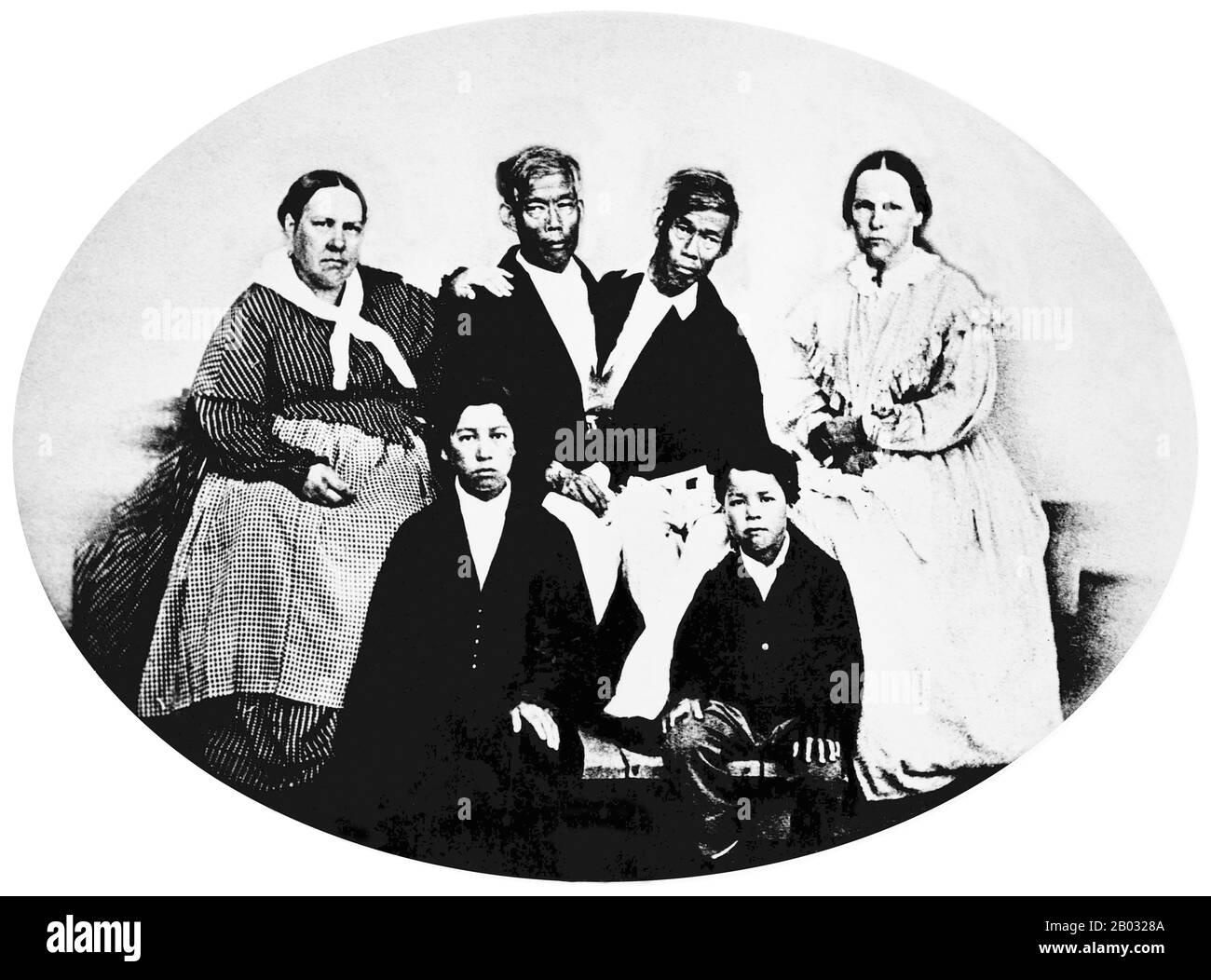 Chang et Eng Bunker (11 mai 1811 – 17 janvier 1874) étaient des frères jumeaux thaïlandais-américains dont la condition et le lieu de naissance sont devenus la base du terme 'jumeaux siamois'. Les frères Bunker sont nés le 11 mai 1811 dans la province de Samutsongkram, près de Bangkok, dans le Royaume de Siam (Thaïlande d'aujourd'hui). Leur père pêcheur était un Chinois thaïlandais, alors que leur mère était un Chinois malaisien. En raison de leur héritage chinois, ils étaient connus localement sous le nom de "Twins chinois". Les frères ont été joints au sternum par un petit morceau de cartilage, et bien que leurs foies aient été fusionnées, ils se serrent Banque D'Images