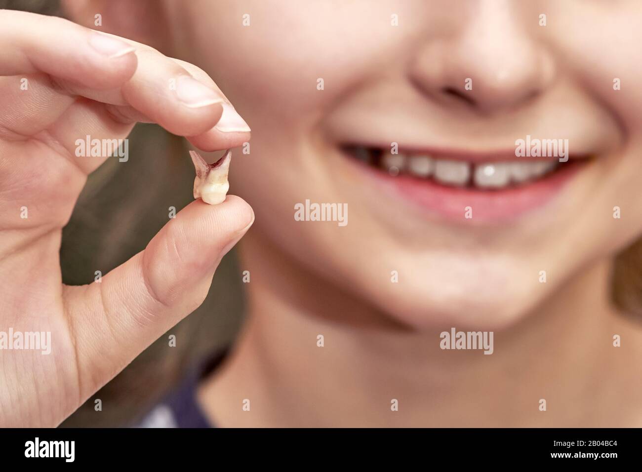 Une petite fille tient une dent tombée dans sa main et sourit. Gros plan, mise au point sélective Banque D'Images