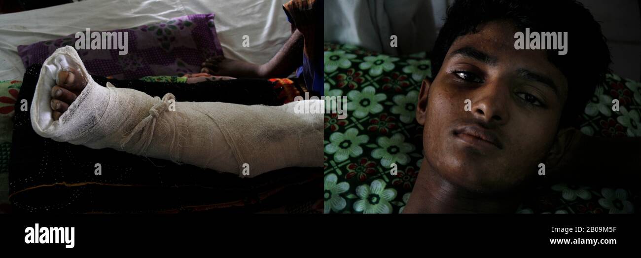 La jambe de Tajul Islam, 17 ans, a été brisée en bus qui l'a frappé en traversant une route, à Soir Akhra, à Narayanganj, au Bangladesh. 28 Août 2011. Une des images de photo Story, Tears on Highways, de Noor Alam. Banque D'Images
