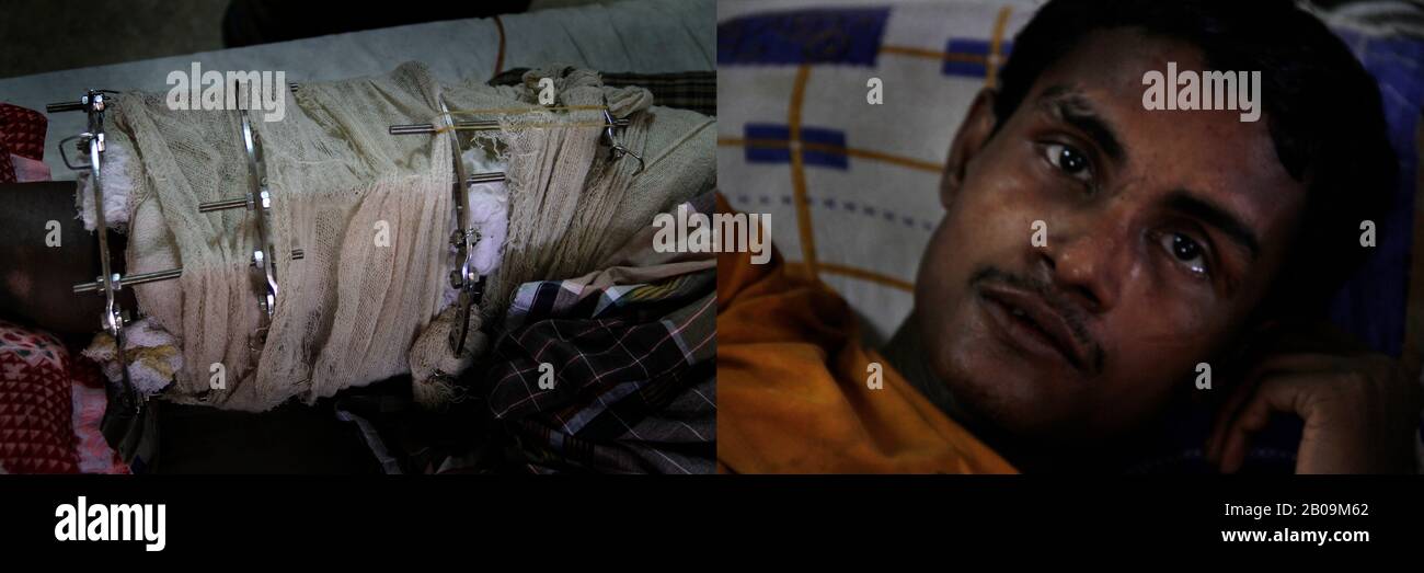 Sheikh Liton, 26 ans, a brisé sa jambe lorsqu'un camion de vitesse a frappé sa camionnette en pousse-pousse à Jessore. "Je ne pourrai Probablement jamais tirer à nouveau le camionnette en pousse-pousse. Je souhaite que le gouvernement ait fourni des prêts et des formations pour les handicaps afin qu’ils puissent survivre en gagnant un moyen de subsistance ». Monirampur, Jessore, Bangladesh. 28 Août 2011. Une des images de photo Story, Tears on Highways, de Noor Alam. Banque D'Images