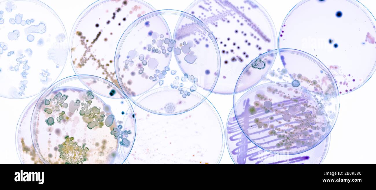 Culture De Bactéries dans Les Boîtes de Petri sur gel de gélose expérience scientifique. Banque D'Images