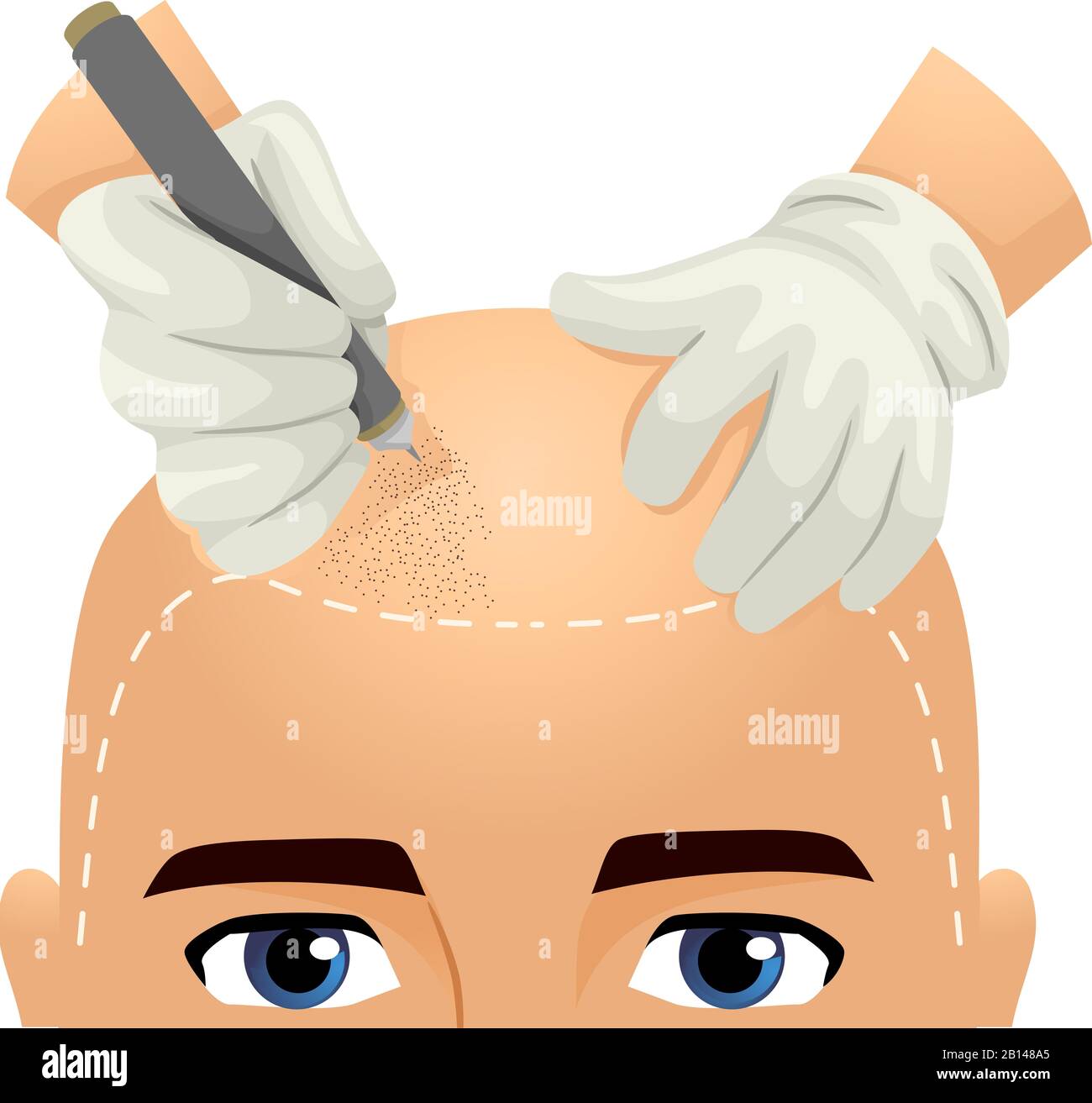 Illustration d'un homme Recevant des tatouages De Cheveux sur la tête par une paire De Mains Portant des gants et Utilisant Pen Tattoo Banque D'Images