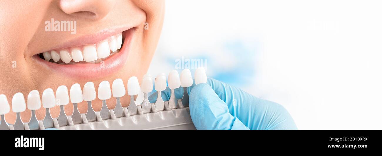 Beau sourire et des dents blanches d'une jeune femme. La correspondance des couleurs de l'implants ou le processus de blanchiment des dents. Banque D'Images