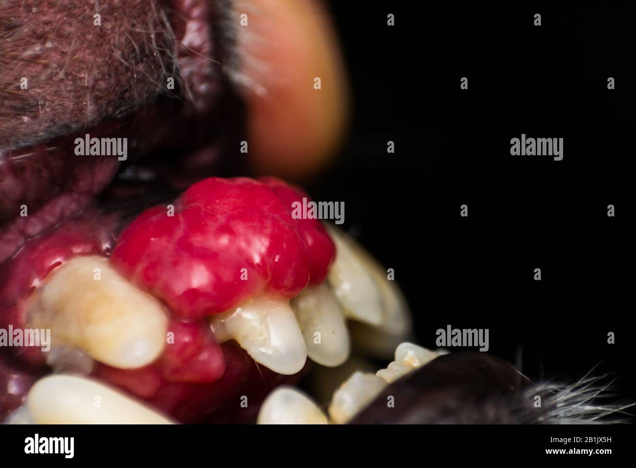 Epulis Banque D Image Et Photos Alamy Epulis Banque D Image Et Photos Alamy