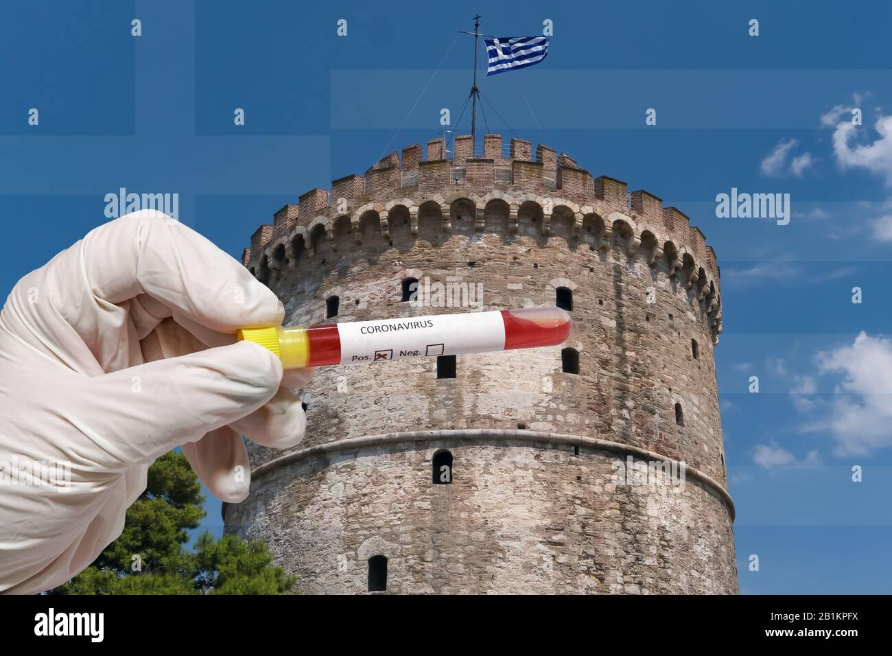 Thessalonique Grèce Coronavirus COVID-19 concept mondial d'éclosion. Chimiste avec gants pour le prélèvement sanguin avec le virus 2019-nCoV avant La Tour Blanche. Banque D'Images