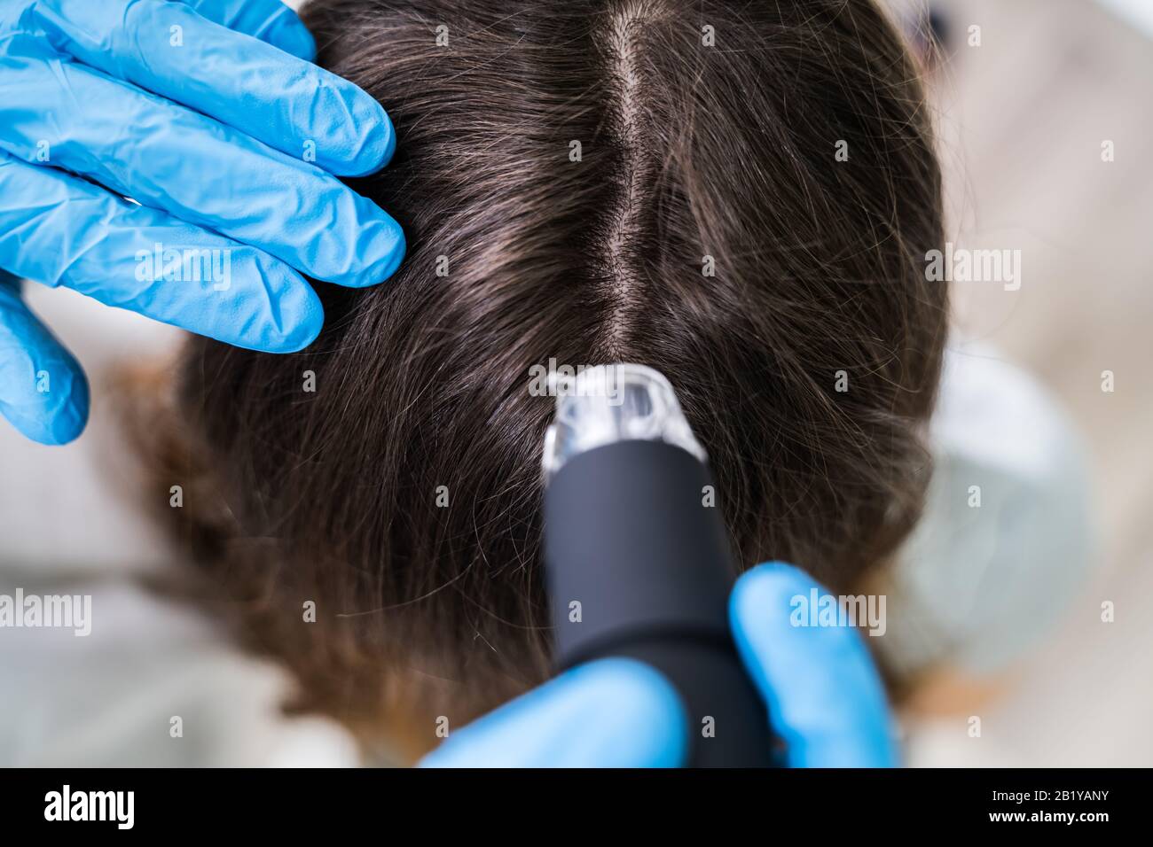 Close-up de l'aide de dermatologues Trichoscope pour sa Clinique de traitement Chute des cheveux Banque D'Images Close-up de l'aide de dermatologues Trichoscope pour sa Clinique de traitement Chute des cheveux Banque D'Images