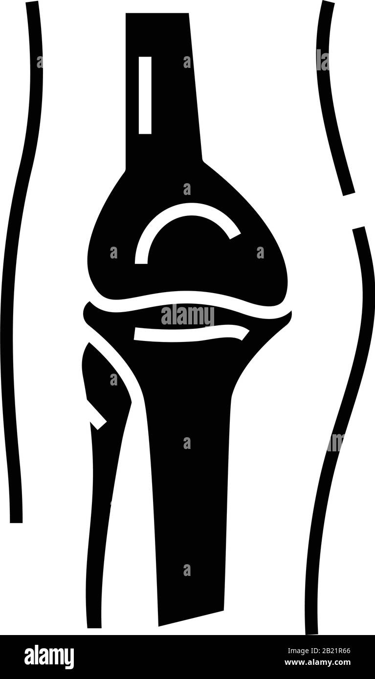 Diarthroses structure interne icône noire, illustration du concept, symbole vectoriel plat, signe glyphe. Illustration de Vecteur