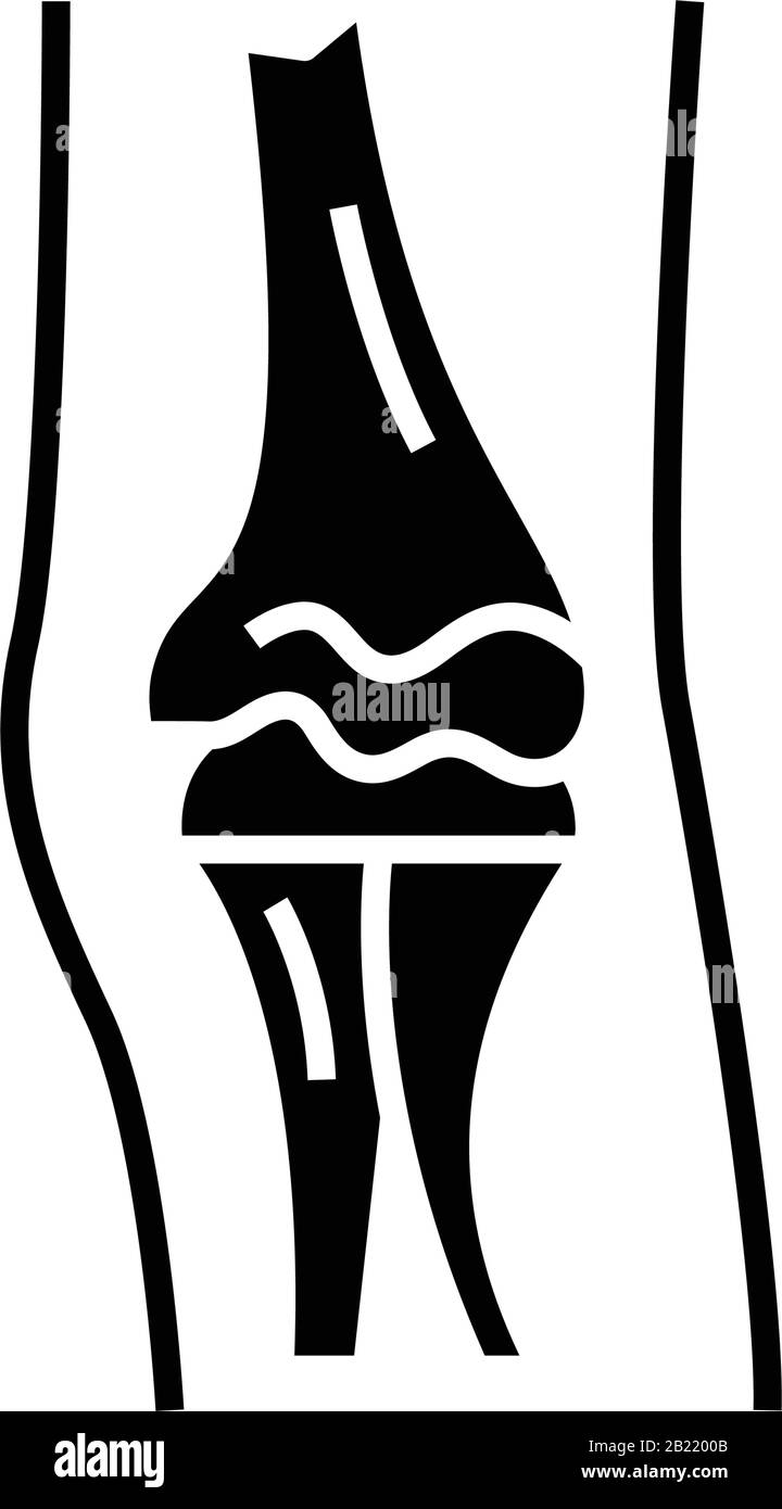 Diarthroses structure icône noire, illustration de concept, symbole vectoriel plat, signe glyphe. Illustration de Vecteur