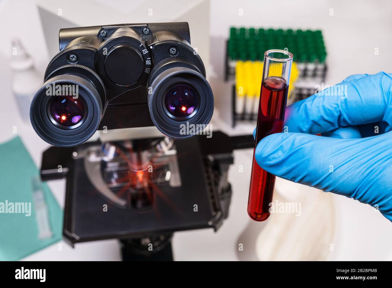 Microscope optique de laboratoire. Tube de test de diagnostic en main avec gant bleu. Médecin analysant l'échantillon clinique scientifique. Infection virale ou bactérienne. Banque D'Images
