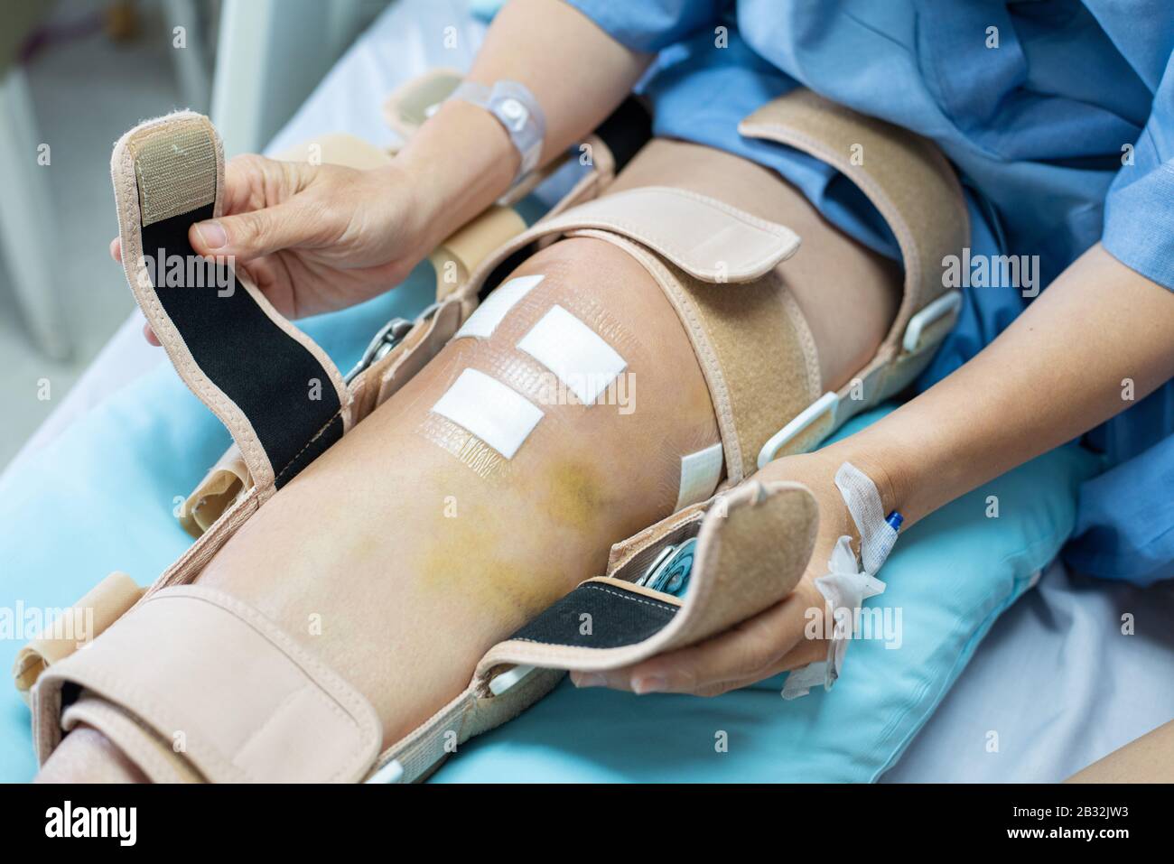 Main de la femme asiatique assise sur le lit à l'hôpital essayer de porter le soutien de genouillère après une chirurgie postérieure du ligament cruciat.soins de santé et médical Banque D'Images