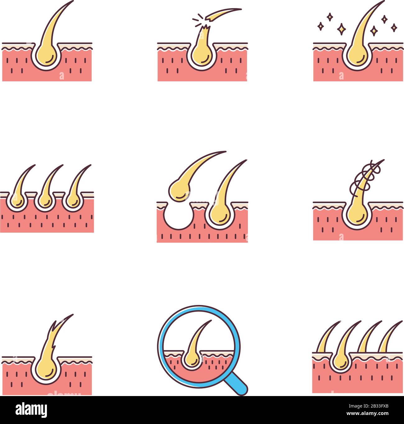 Jeu d'icônes de couleur RVB perte de cheveux. Cheveux endommagés, racines malsaines. Cuir chevelu et follicule. Tissu cutané. Traitement de dermatologie, problème de soins capillaires. Alopécie et Illustration de Vecteur