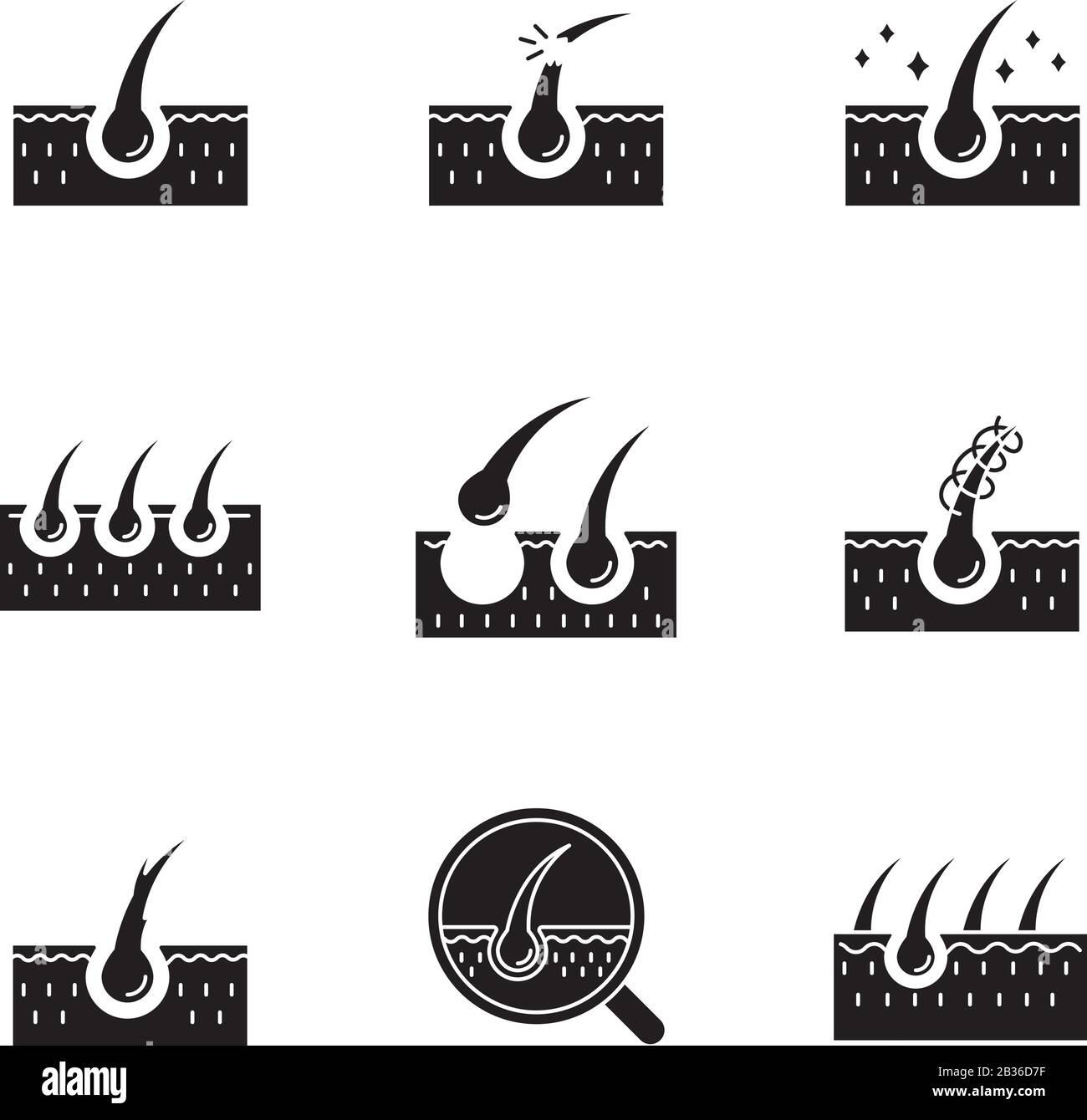 Les icônes de glyphe noir de perte de cheveux se définissent sur l'espace blanc. Cheveux endommagés, racines malsaines. Cuir chevelu et follicule. Tissu cutané. Alopécie et balding. Silhouette Illustration de Vecteur