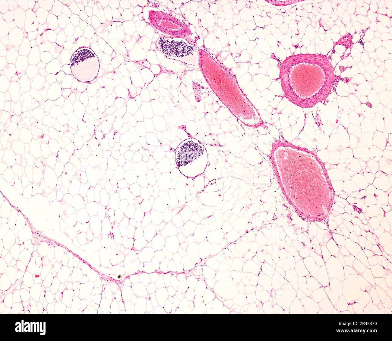 Deux artères musculaires, deux veines et trois vaisseaux lymphatiques entourés de tissu adipeux. Les vaisseaux lymphatiques sont identifiés par des lymphocytes Banque D'Images