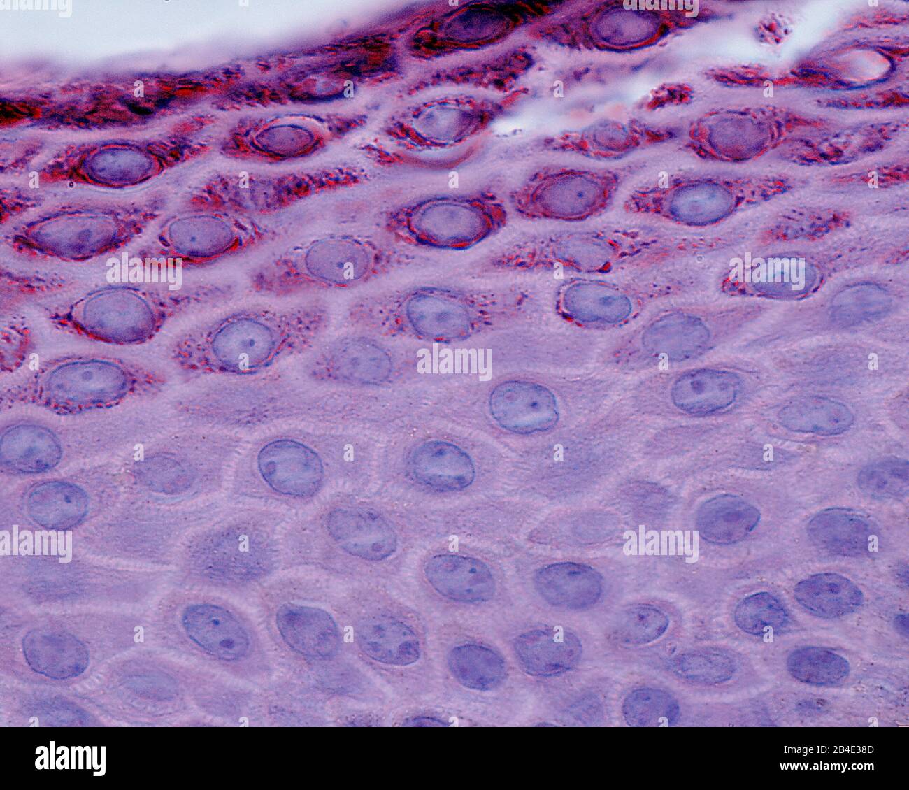 Micrographe léger montrant la stratum spinosum (fond) et la stratum granulosum (couche granuleuse) de l'épiderme de la peau. Banque D'Images
