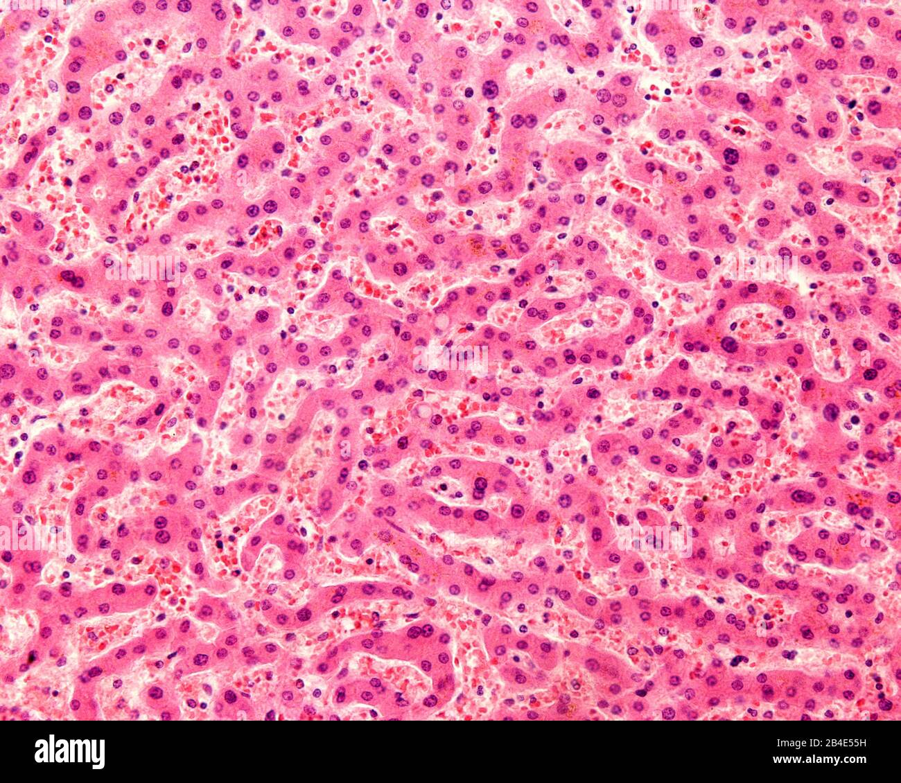 Micrographe léger d'un foie humain taché d'hématoxyline et d'éosine. Les hépatocytes sont disposés en cordons séparés par des zones claires où le péché hépatique est présent Banque D'Images