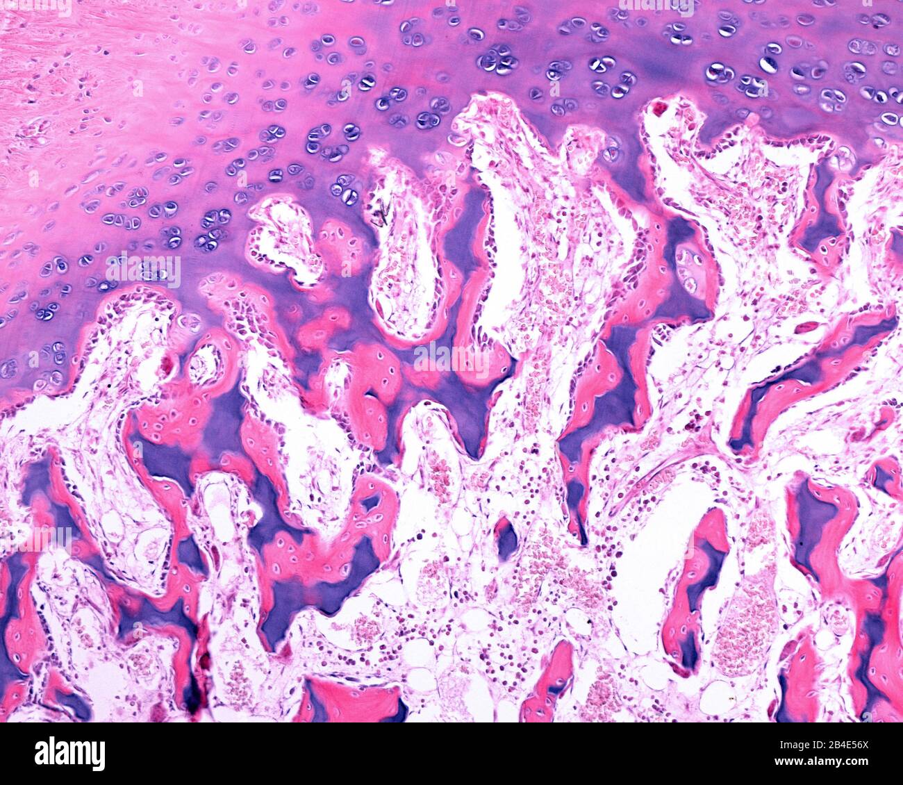 Trabeculae mixte généré dans l'ossification épiphysaire. Contrairement à ceux formés dans l'épiphysaire ou le cartilage de croissance, le trabeculae mélangé de l'épiphyse Banque D'Images