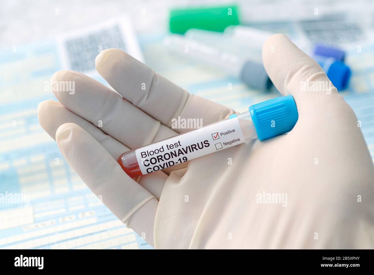 Coronavirus 2019-nCoV originaire de Wuhan, Chine. Concept de test sanguin du coronavirus. Main du médecin dans le gant médical tenant le tube à essai avec la pos. Coronavirus Banque D'Images