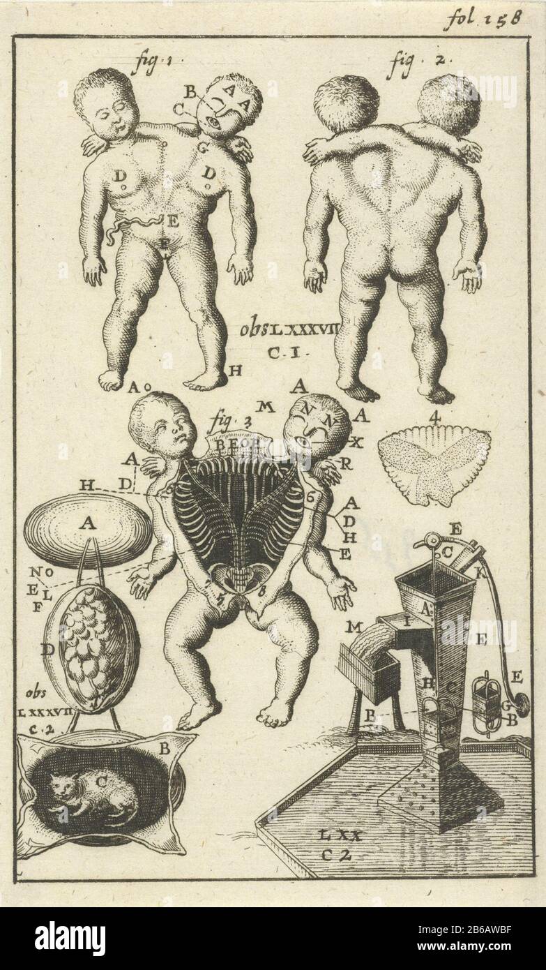 Schéma anatomique VI Imprimer à droite libellé : FOL. 158. Fabricant : print maker: Zwaansvliet Editeur: John Claesz at Hear Place fabricación: Amsterdam Date: 1680 - 1688 Caractéristiques physiques: Matière de gravure: Technique du papier: Dimensions de gravure: Feuille: 139 mm × H b 84 mmLelielicktingillustratie figurant dans: Blankaart, Steven. Collectanea medico-physica, souvent Hollands année-registre du médicament et de la nature qualifiés dans les remarques d'art, 3 parties, vol. I, fol. 158. Amsterdam: Jan Claesz À Hoorn, 1680-1688. Objet : modèles anatomiques (généralement série de cinq figures) biologie Banque D'Images