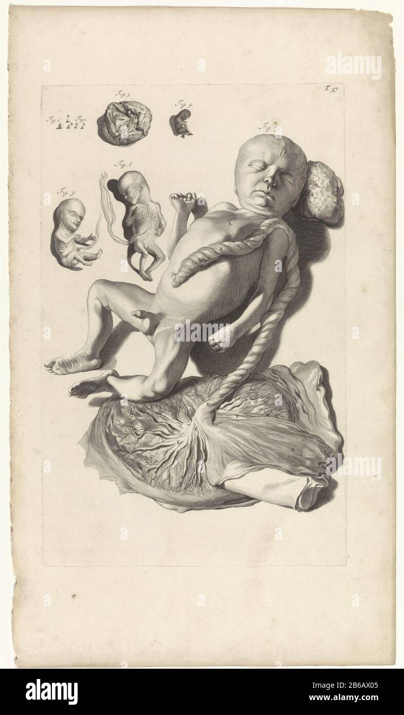 Étude anatomique d'une étude anatomique fœtale d'un fœtus. En haut à droite numéroté T. 57. Fabricant : print maker: Pieter of Grace In drawing: Gerard de Lairesse Éditeur: Veuve Joannes van Someren Éditeur: Hendrick and Dirk Tree City manufacture: Amsterdam Date: 1685 Caractéristiques physiques: Engraa and dot engrala matière: Papier technique: Engraa (processus d'impression) mesures: Bord de la plaque b 278 mm × h 438 mmToelichtingBoekillustratie pour Bidloo, Godefridus. Anatomia humani corporis centum & quinque tabules est selon l'art. G. de Lairesse ad vivum detratis les monstrates, veteum recentiorumque Banque D'Images