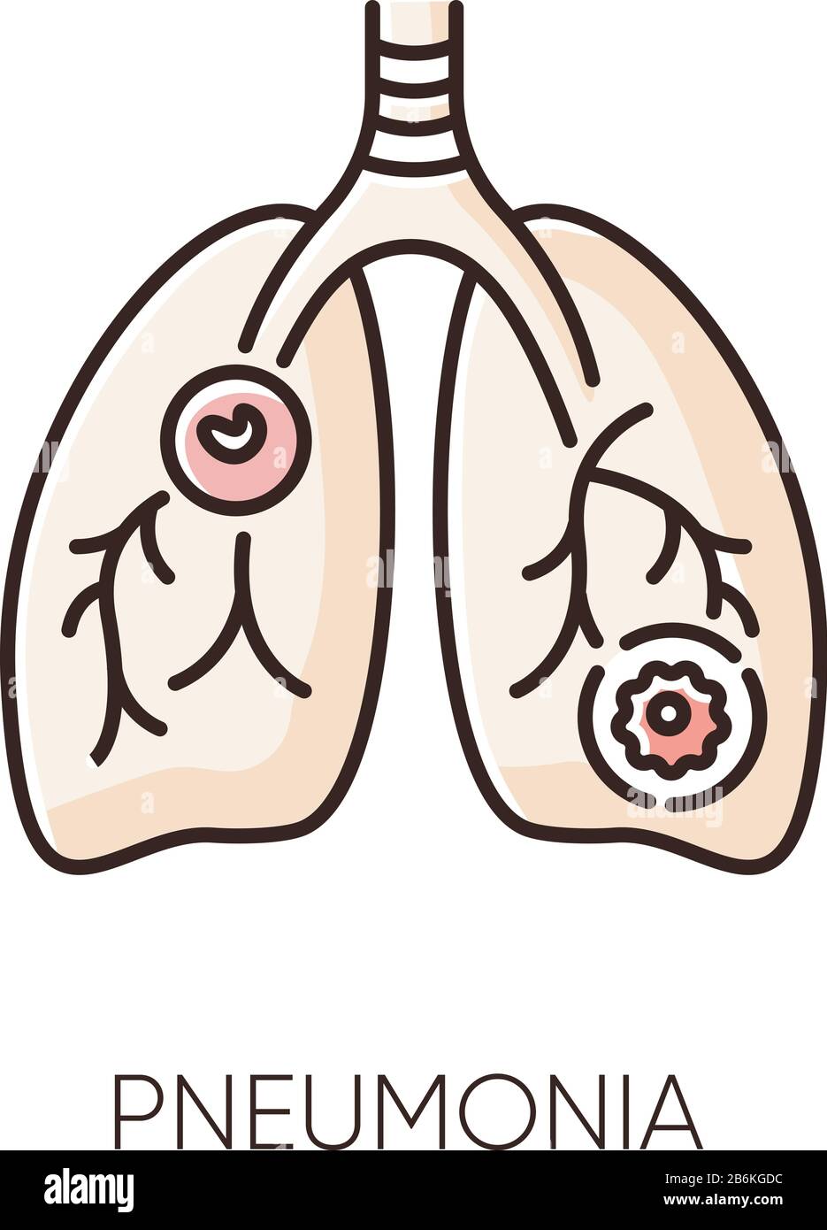 Icône couleur RVB pneumonie. Maladie respiratoire dangereuse, maladie pulmonaire. Diagnostic médical, virologie. Infection par Streptococcus, bactéries mycoplasmiques Illustration de Vecteur