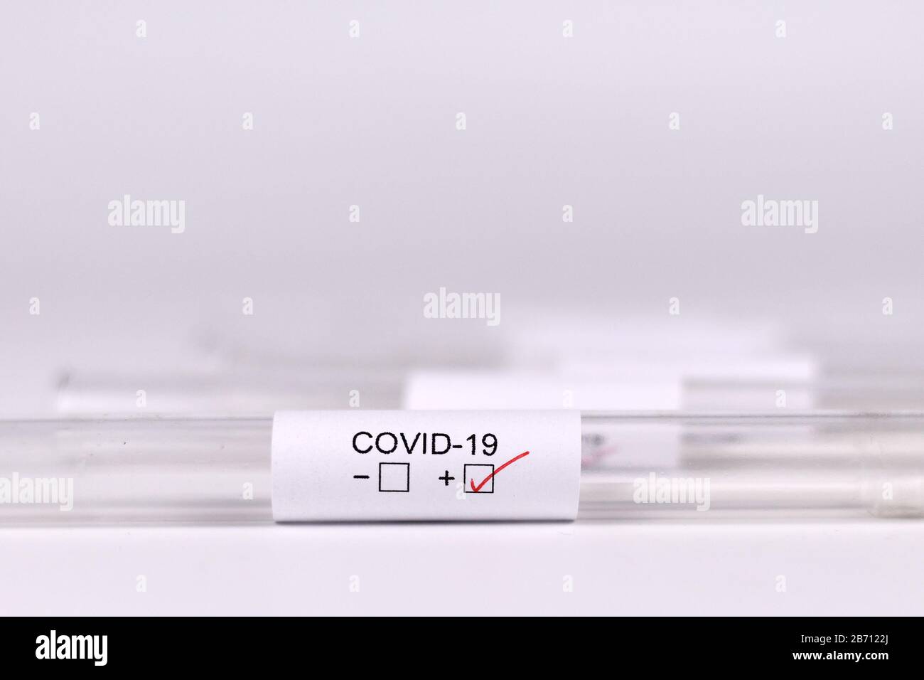 Échantillon de tube d'essai médical pour coronavirus avec étiquette Covid-19 avec résultat positif Banque D'Images