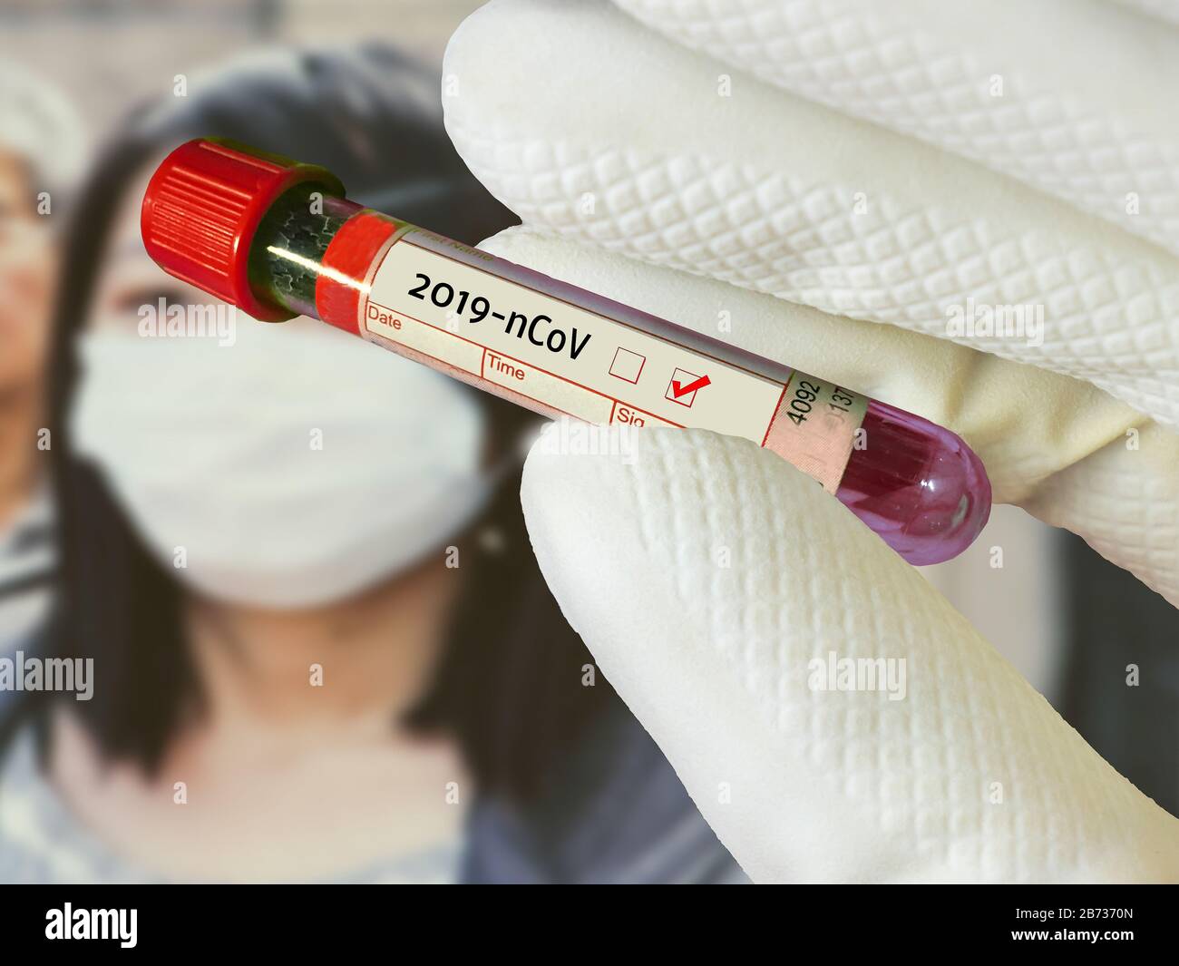 2019 tubes de sang positif de test nCoV à l'hôpital Banque D'Images