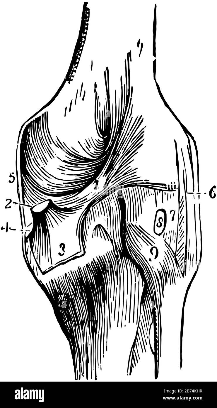 Cette illustration représente l'articulation du genou, le dessin de lignes anciennes ou l'illustration de gravure. Illustration de Vecteur