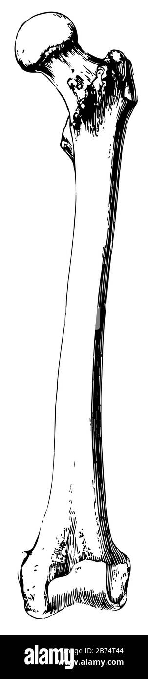 L'os du fémur ou de la cuisse l'os le plus grand et le plus lourd du corps atteint de la hanche au genou, dessin vintage de ligne ou illustration de gravure. Illustration de Vecteur L'os du fémur ou de la cuisse l'os le plus grand et le plus lourd du corps atteint de la hanche au genou, dessin vintage de ligne ou illustration de gravure. Illustration de Vecteur