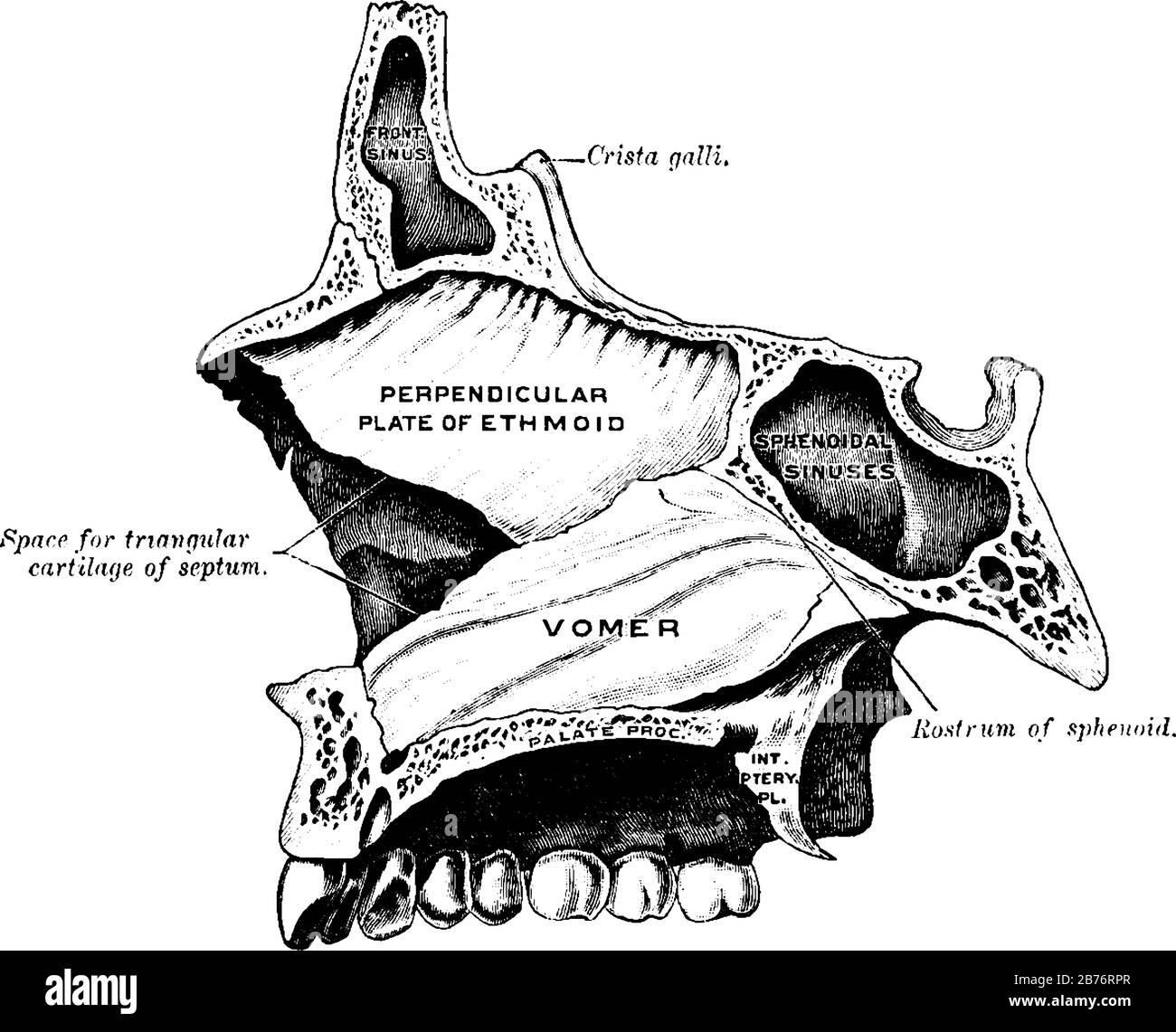 Cette illustration représente Le Vomissement, le dessin de ligne vintage ou l'illustration de gravure. Illustration de Vecteur