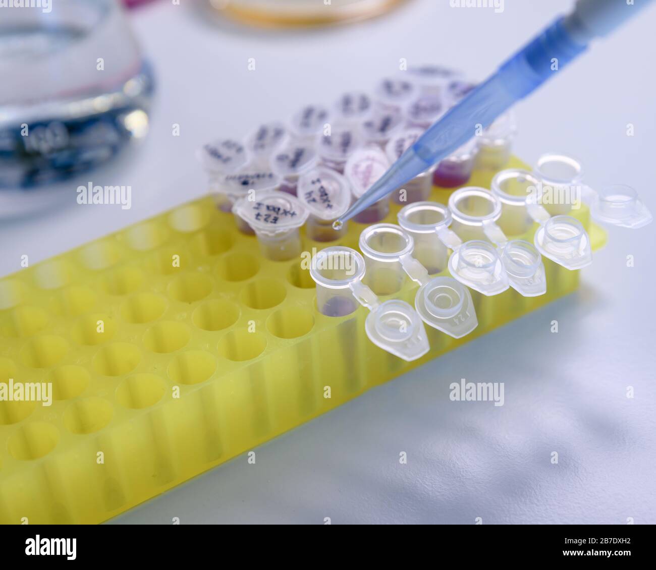 Pipette de gros plan avec goutte de liquide sur portoir de tubes en plastique pour les études d'ADN. Concept de la science, du laboratoire et de l'étude des maladies. Banque D'Images