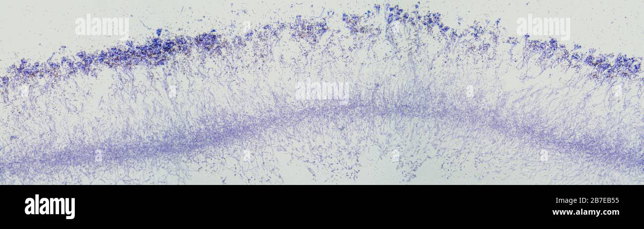 Penicillium, champignons ascomycètes, sous le microscope. Pour les humains, les ascomycètes sont une source de composés médicinaux, tels que les antibiotiques ou la fermentation. Banque D'Images