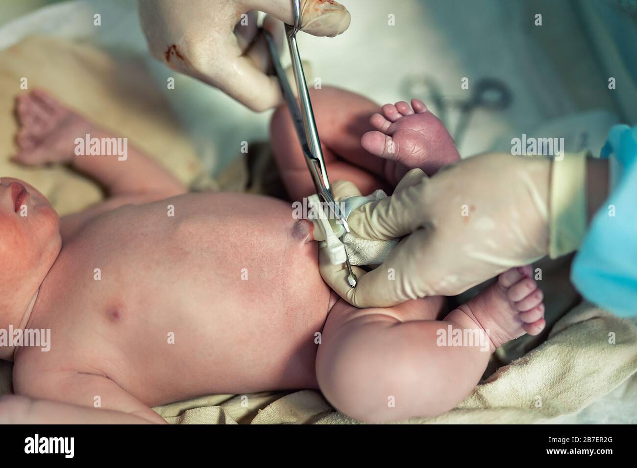 Medecin De Gros Plan Infirmiere Obstetricienne Couper Cordon Ombilical Avec Des Ciseaux Medicaux A Nouveau Ne Bebe Chirurgien Medical Donnant Naissance A L Enfant Nouveau Photo Stock Alamy