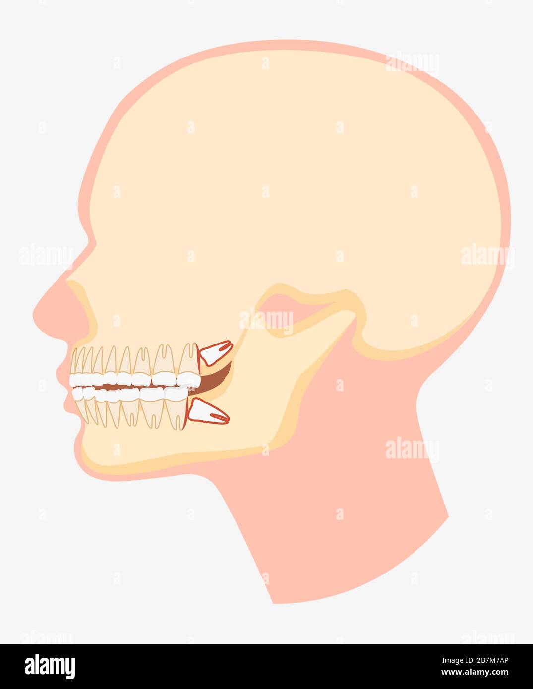Modèle de dessin animé de l'illustration plate vectorielle de la vue latérale de la mâchoire dentaire humaine Illustration de Vecteur