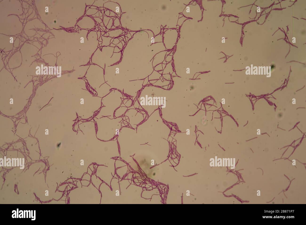 Bacillus anthrax sous le microscope 200 x. Banque D'Images