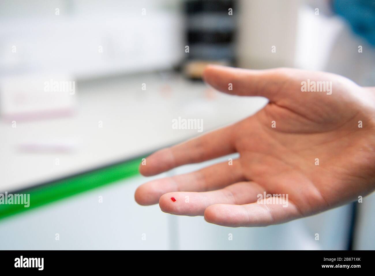 Le sang capillaire sur un bout de doigt lors d'une démonstration à Surescreen Diagnostics, basé à Derby, d'un test qu'ils ont fabriqué qui prétend être de 98% précis pour déterminer si une personne est infectée par le coronavirus, coûte £6 et peut être utilisé en 10 minutes. Banque D'Images