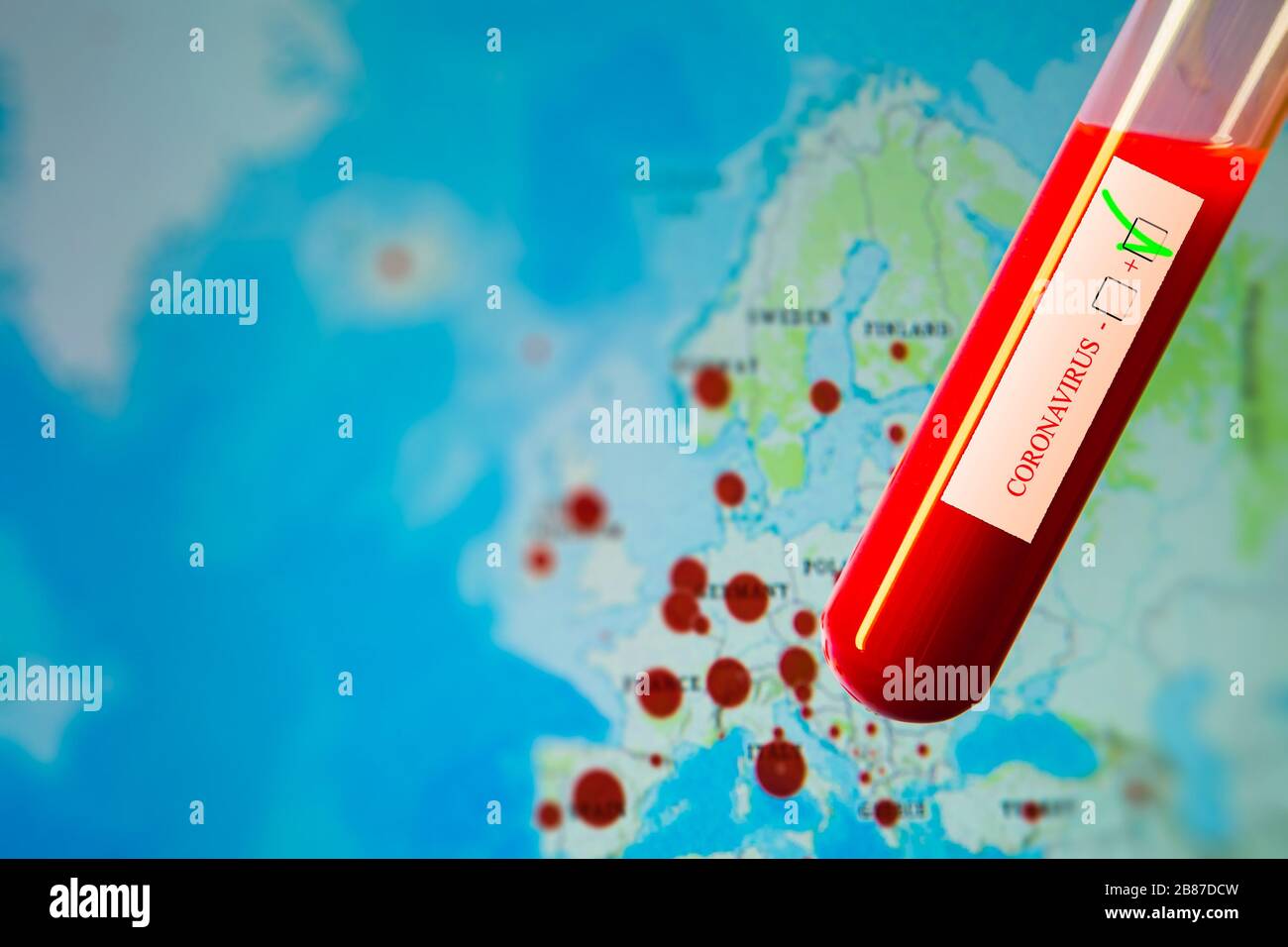 Pandémie de coronavirus, test positif nCoV 2019, carte de l'Europe en arrière-plan avec des cas de propagation Banque D'Images