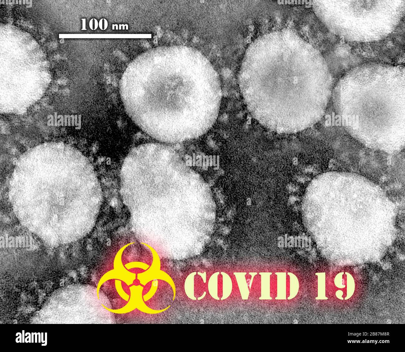 Coronavirus - COVID-19. Syndrome respiratoire aigu sévère coronavirus 2 (SRAS-CoV-2), précédemment connu sous le nom provisoire 2019 nouveau coronavirus Banque D'Images