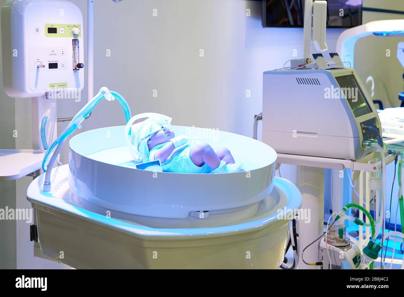 Appareil de ventilation artificielle des poumons pour les nouveau-nés à l'hôpital Banque D'Images