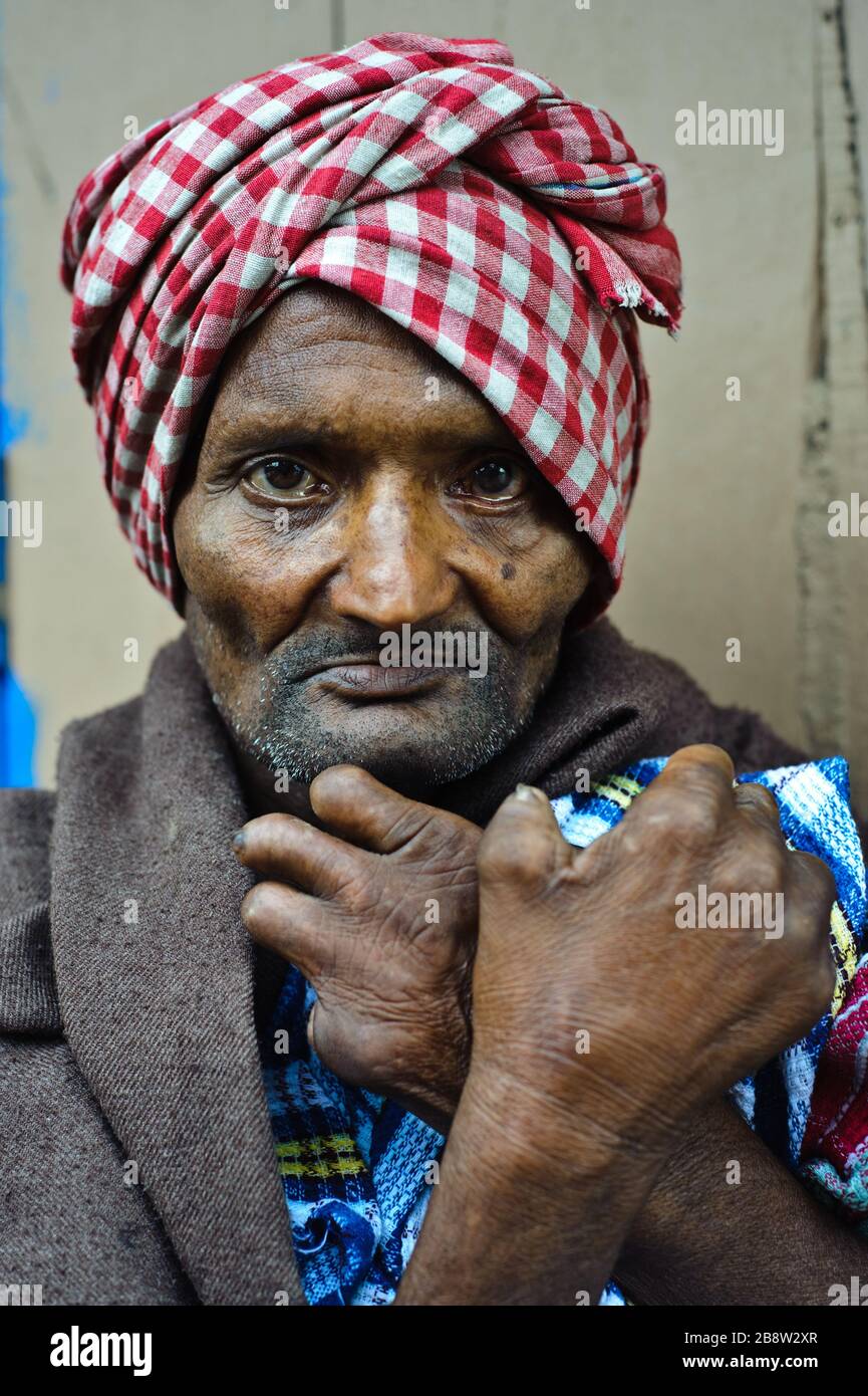 Léper (Inde). C'est un mendiant. Banque D'Images