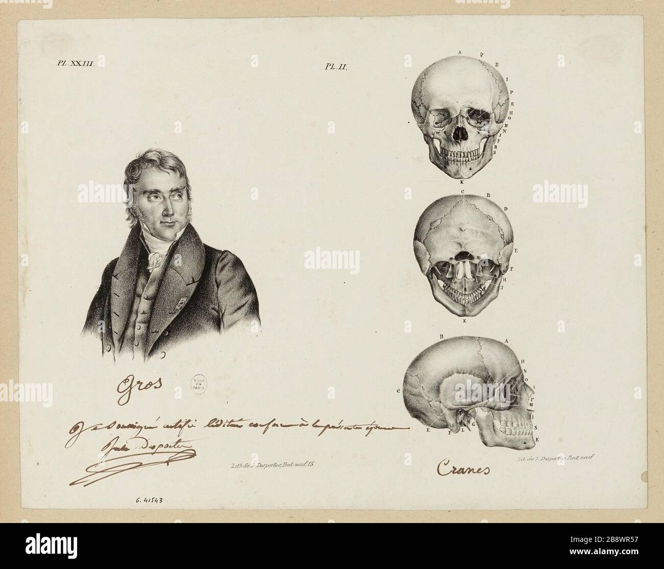 Portrait buste gros (plaque 23) et vues avant, profil et arrière d'un crâne humain (plaque 2) Banque D'Images