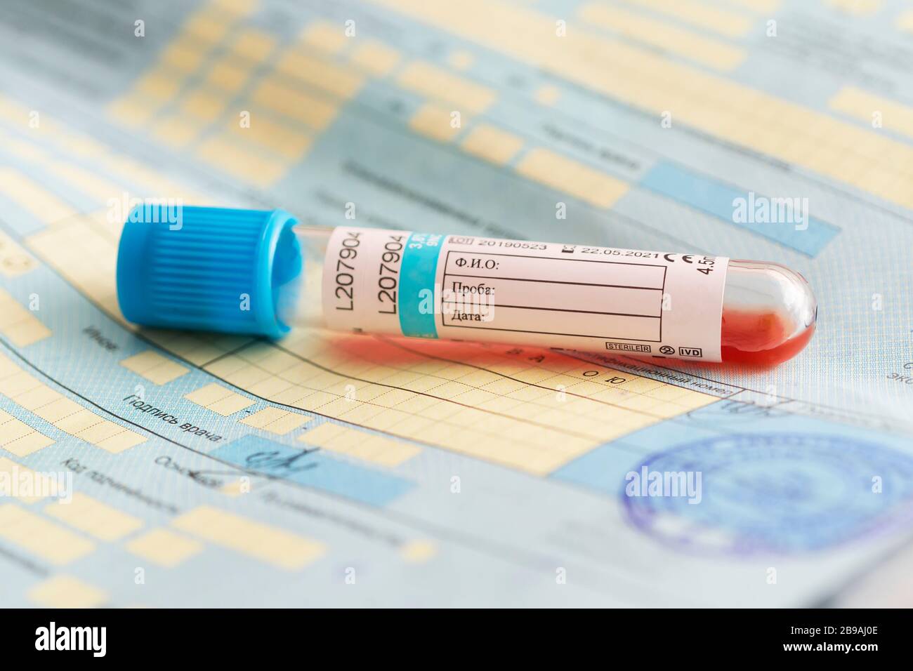 Un tube à essai avec un test sanguin sur un document d'hôpital. Traduction en russe : nom complet, échantillon de sang, date, signature du médecin. Banque D'Images